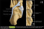 Accessory Navicular Types